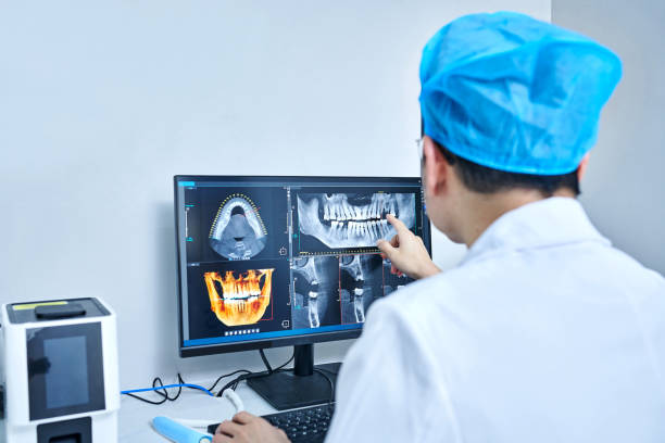 Best Emergency Tooth Extraction in Mount Juliet, TN
